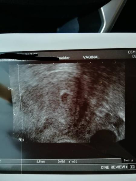 Bild zu Zurück vom 1. US 5+2 - Forum für August - Mamis