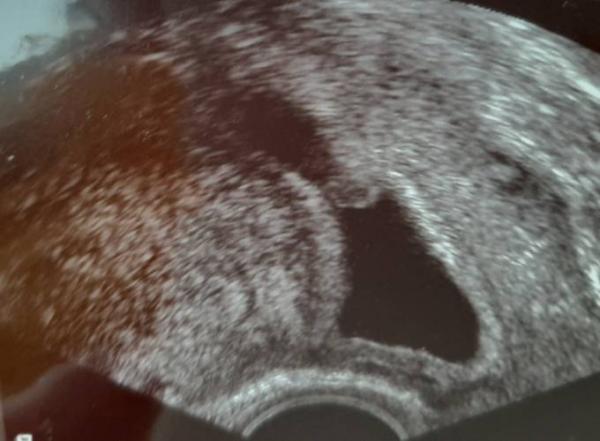 Bild zu Alles gut nach den Blutungen - Forum für August - Mamis