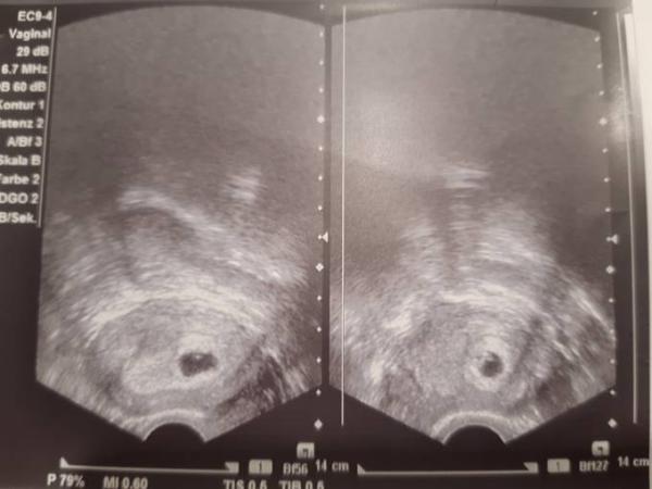 Bild zu Beim Arzt 5+1 - Forum für August - Mamis