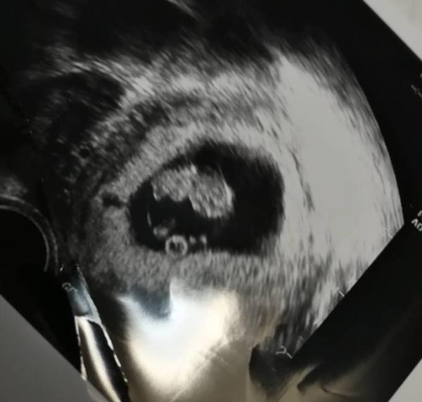 Bild zu Juhu 😍 - Forum für August - Mamis