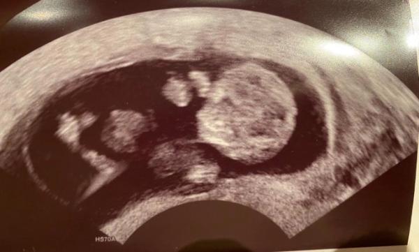 Bild zu Zurück vom Gyn - Forum für August - Mamis