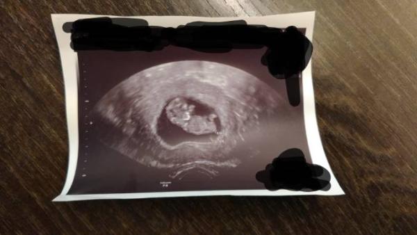 Bild zu Ich zieh dann mal um... - Forum für August - Mamis