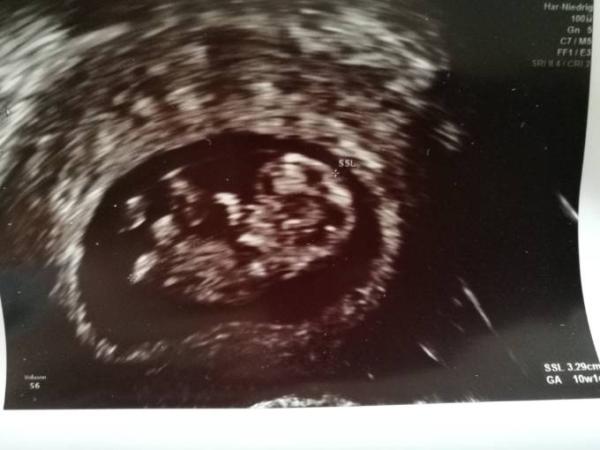 Bild zu Zurück vom Gyn mit guten Nachrichten - Forum für August - Mamis