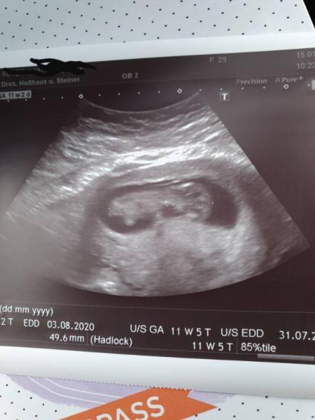 Bild zu Zurück vom Arzt 11+2 - Forum für August - Mamis