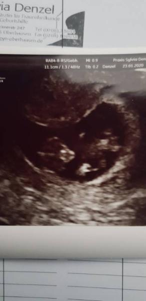 Bild zu 2 Termin durch 11 ssw - Forum für August - Mamis