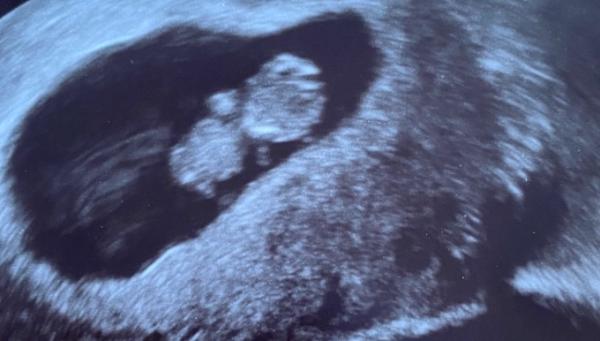 Bild zu Noch mehr Glück... - Forum für August - Mamis