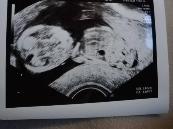 Bild zu Entwarnung - Forum für August - Mamis