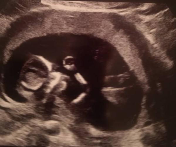 Bild zu Haltestelle 14 SSW - Forum für August - Mamis
