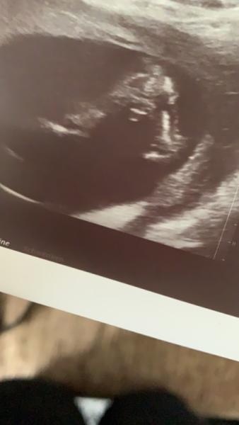 Bild zu Ebenfalls heute Termin gehabt - Forum für August - Mamis