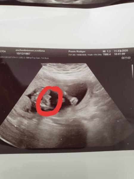 Bild zu Mädchen oder Junge ? - Forum für August - Mamis