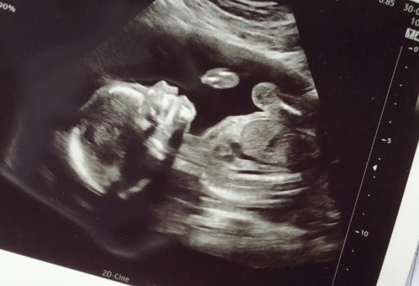 Bild zu Vom Arzt zurück - Forum für August - Mamis