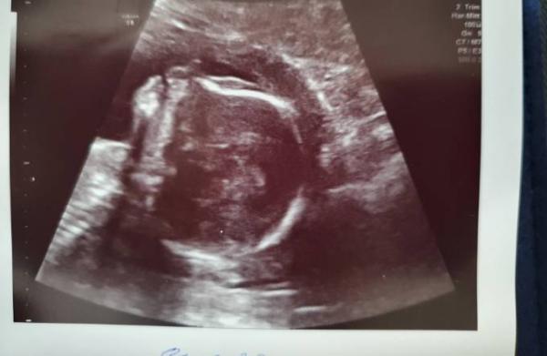 Bild zu Genervt... - Forum für August - Mamis