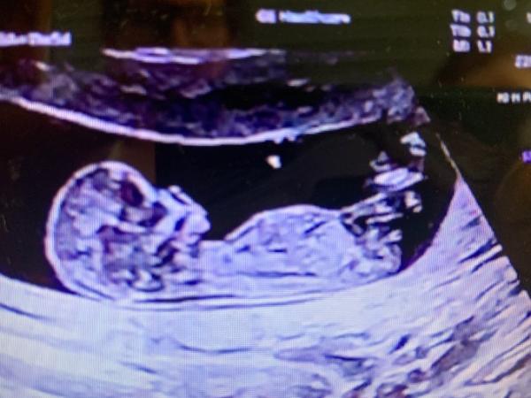 Bild zu Mädchen oder Junge - Forum für August - Mamis
