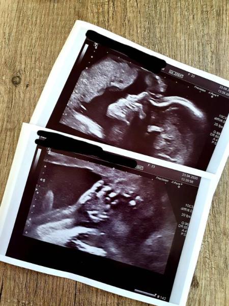 Bild zu Zurück von der Feindiagnostik - Forum für August - Mamis