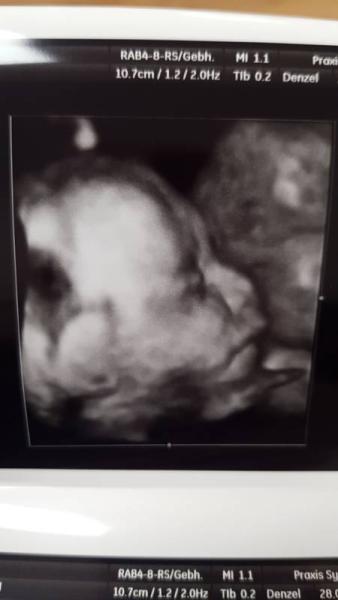 Bild zu Zuckertest und andere Katastrophen - Forum für August - Mamis