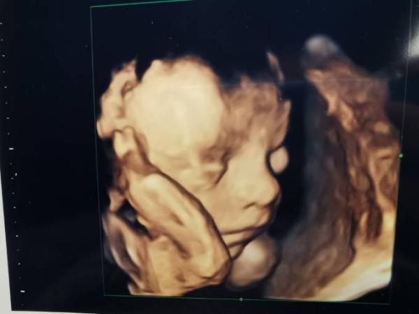Bild zu 4d Bild 😉 - Forum für August - Mamis