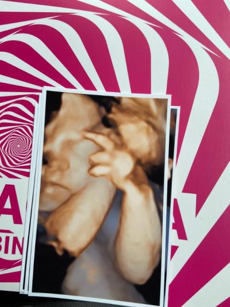 Bild zu Paar Fotos - Forum für August - Mamis