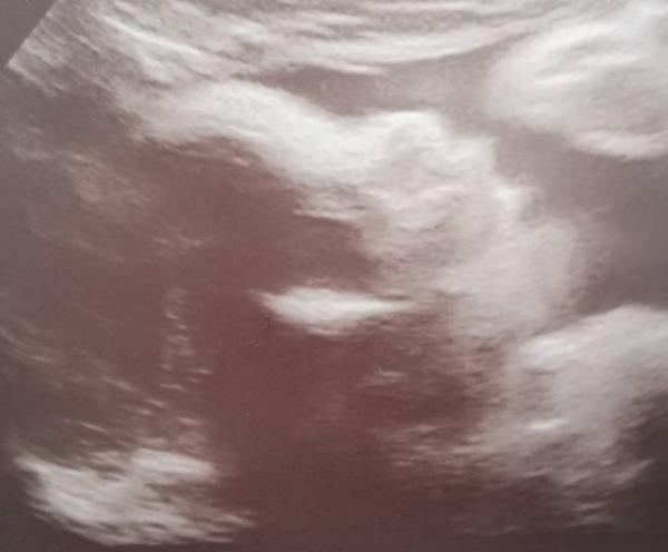 Bild zu 3ter Ultraschall... Baby zu schwer? - Forum für August - Mamis