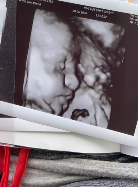 Bild zu Update: - Forum für August - Mamis