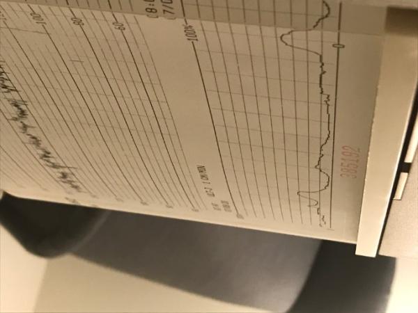 Bild zu Mimimi 🙄 - Forum für August - Mamis