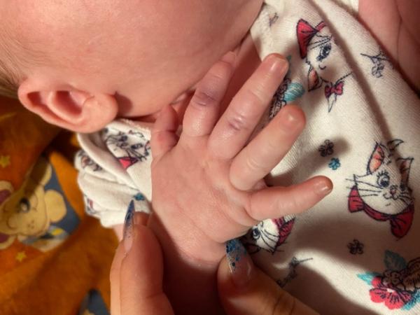 Bild zu Was ist das? Warum? - Forum für August - Mamis
