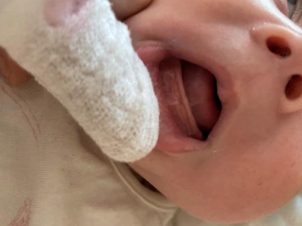 Bild zu Kommen da die ersten Zähne??? - Forum für August - Mamis
