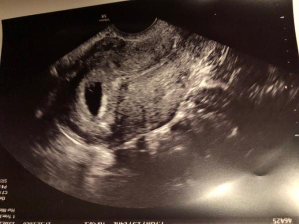 Bild zu 1 US Termin - Forum für August - Mamis