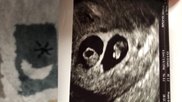 Bild zu 1. FA Termin 💕 - Forum für August - Mamis