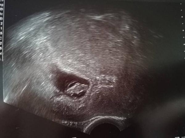 Bild zu Taaaag!  - Forum für August - Mamis