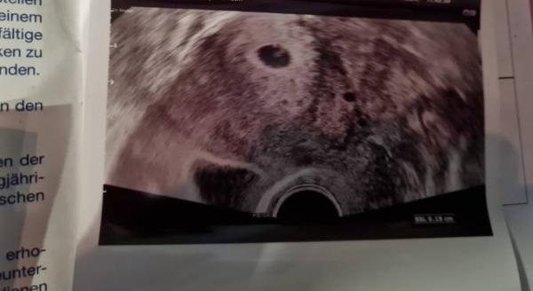 Bild zu Erster FA Termin - Forum für August - Mamis