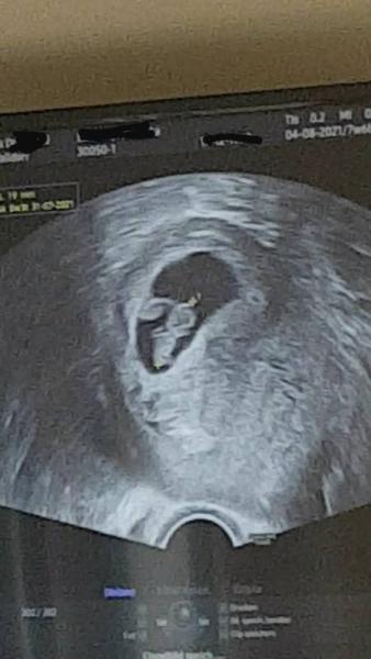 Bild zu In den Juli gerutscht... - Forum für August - Mamis