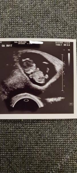 Bild zu Erstes Screening hinter mir - Forum für August - Mamis