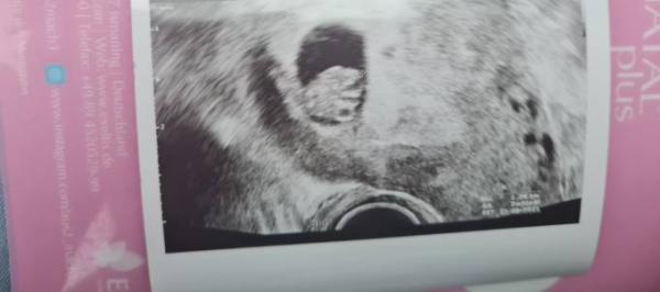 Bild zu Geschafft - Forum für August - Mamis