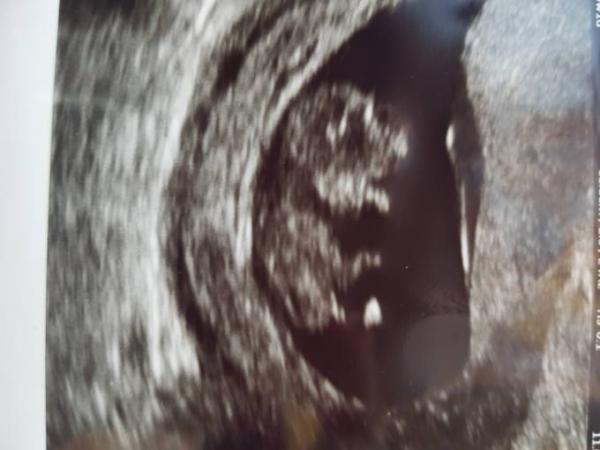 Bild zu Überglücklich - Forum für August - Mamis