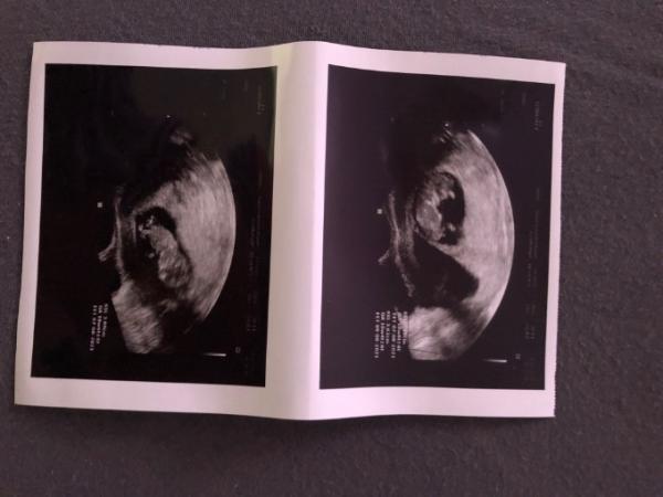 Bild zu Update von den Zwillingen - Forum für August - Mamis
