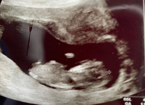 Bild zu ...und hob die Hand zum Gruße - Forum für August - Mamis