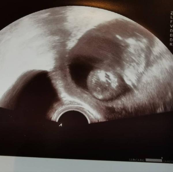 Bild zu Auch wir können aufatmen :) - Forum für August - Mamis