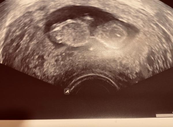 Bild zu Uns geht es gut! :) - Forum für August - Mamis