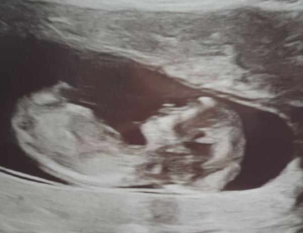 Bild zu Foto teilen - Forum für August - Mamis