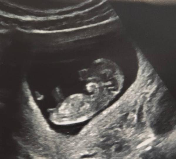Bild zu Hallo, wir sind auch dabei - Forum für August - Mamis