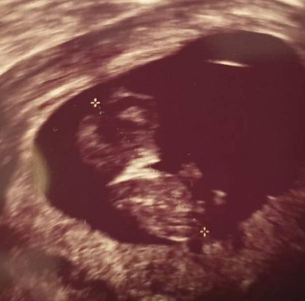 Bild zu Hallo ihr Lieben - Forum für August - Mamis