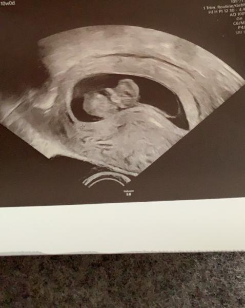Bild zu Mein Bärchen 😍 - Forum für August - Mamis