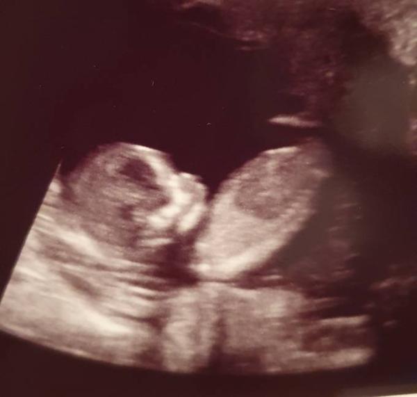 Bild zu Erleichtert und Ultraschall bei 12+4 - Forum für August - Mamis