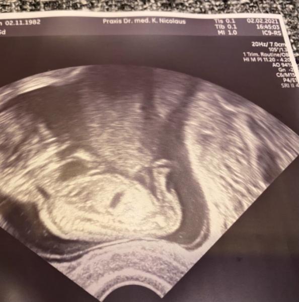 Bild zu Unser Arztbesuch - Forum für August - Mamis
