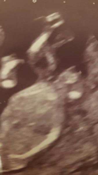 Bild zu Mag jemand einen Tipp abgeben ? - Forum für August - Mamis