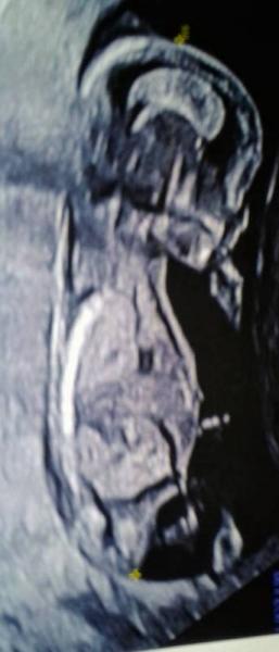 Bild zu meeeegaaaa glücklich - Forum für August - Mamis
