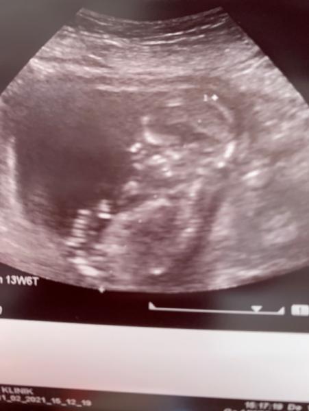Bild zu So Happy😍 - Forum für August - Mamis