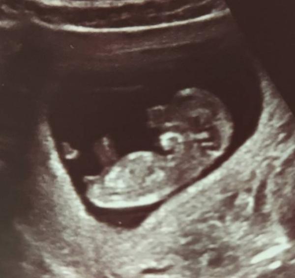 Bild zu Nub / Skull Theorie - Forum für August - Mamis