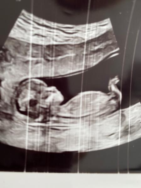 Bild zu Mädchen oder Junge? Experten da?🙂 - Forum für August - Mamis