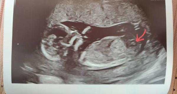 Bild zu Ist das auch der Nub? - Forum für August - Mamis